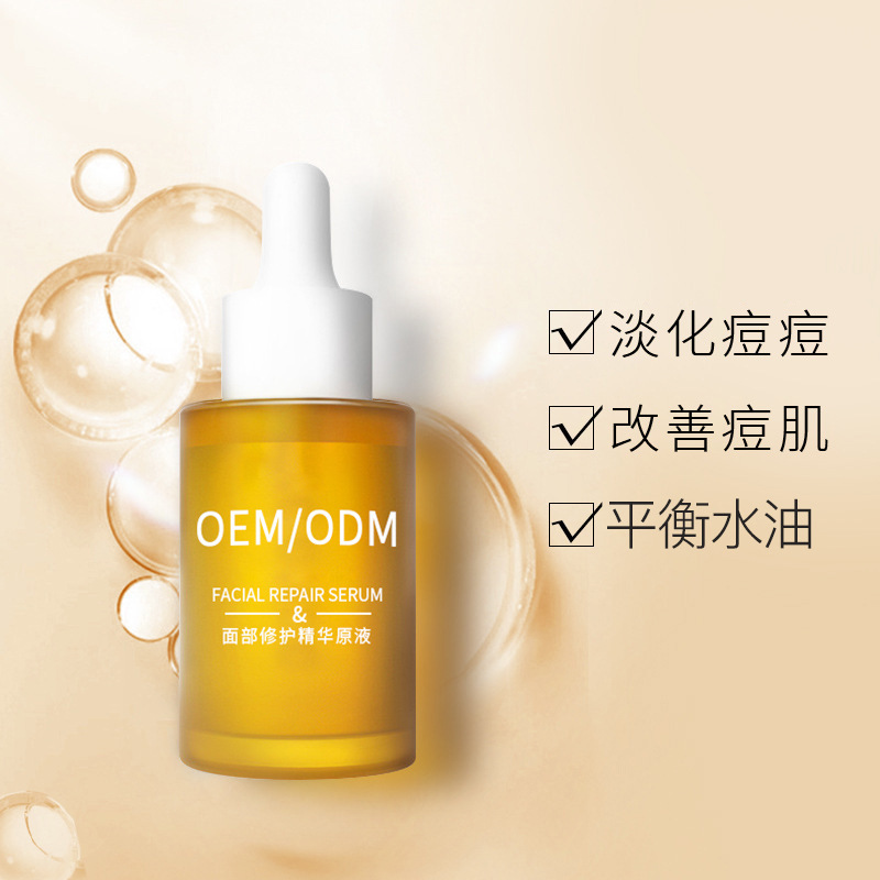 平顶山市_祛痘精华原液OEM